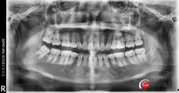成人细绳拔牙视频-第3张图片-午夜无码影院 成人细绳拔牙视频-第3张图片-午夜无码影院