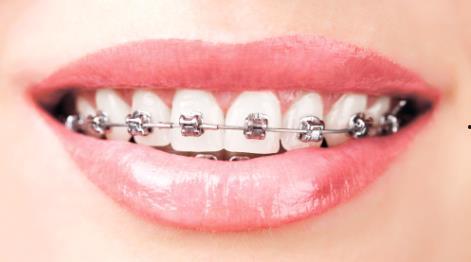 成人反咬合矫正视频,视频教程解析与实操指南-第3张图片-午夜影院