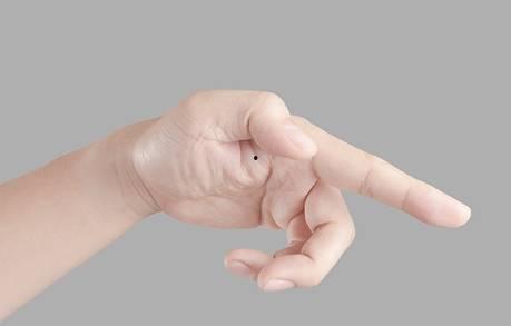 成人疝气可热敷吗视频,缓解不适的实用方法-第3张图片-午夜影院